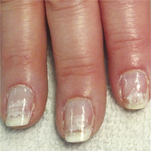 Simple tips for How to Remove Nail Paint and Cloths Stains Simple tips for How to Remove Nail Paint and Cloths Stains