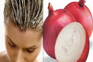 Onions juice for clean your Dandruff